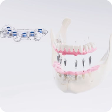 DIO Implant DioNAVI