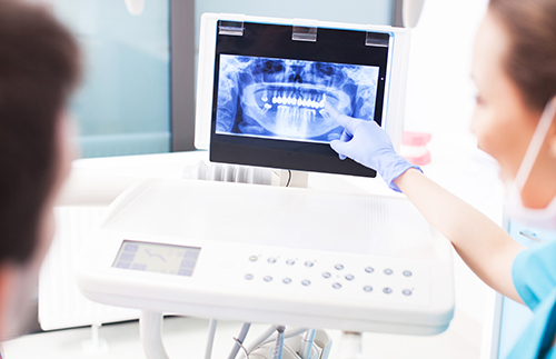 Dentist displaying tooth xray on dental equipment